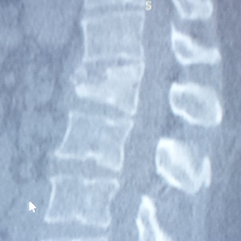 EVERYTHING - Picture 2 of 8